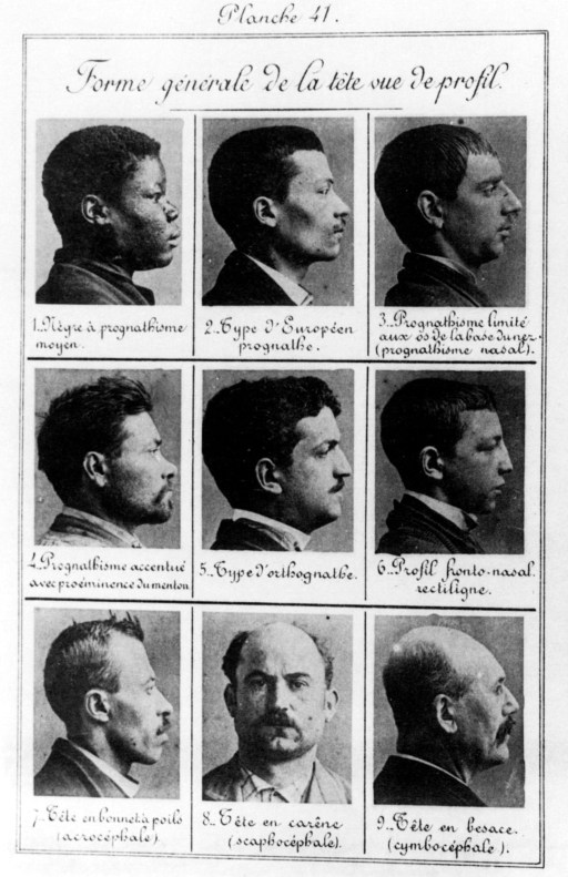 Bertillon_-_Criminal_profiles